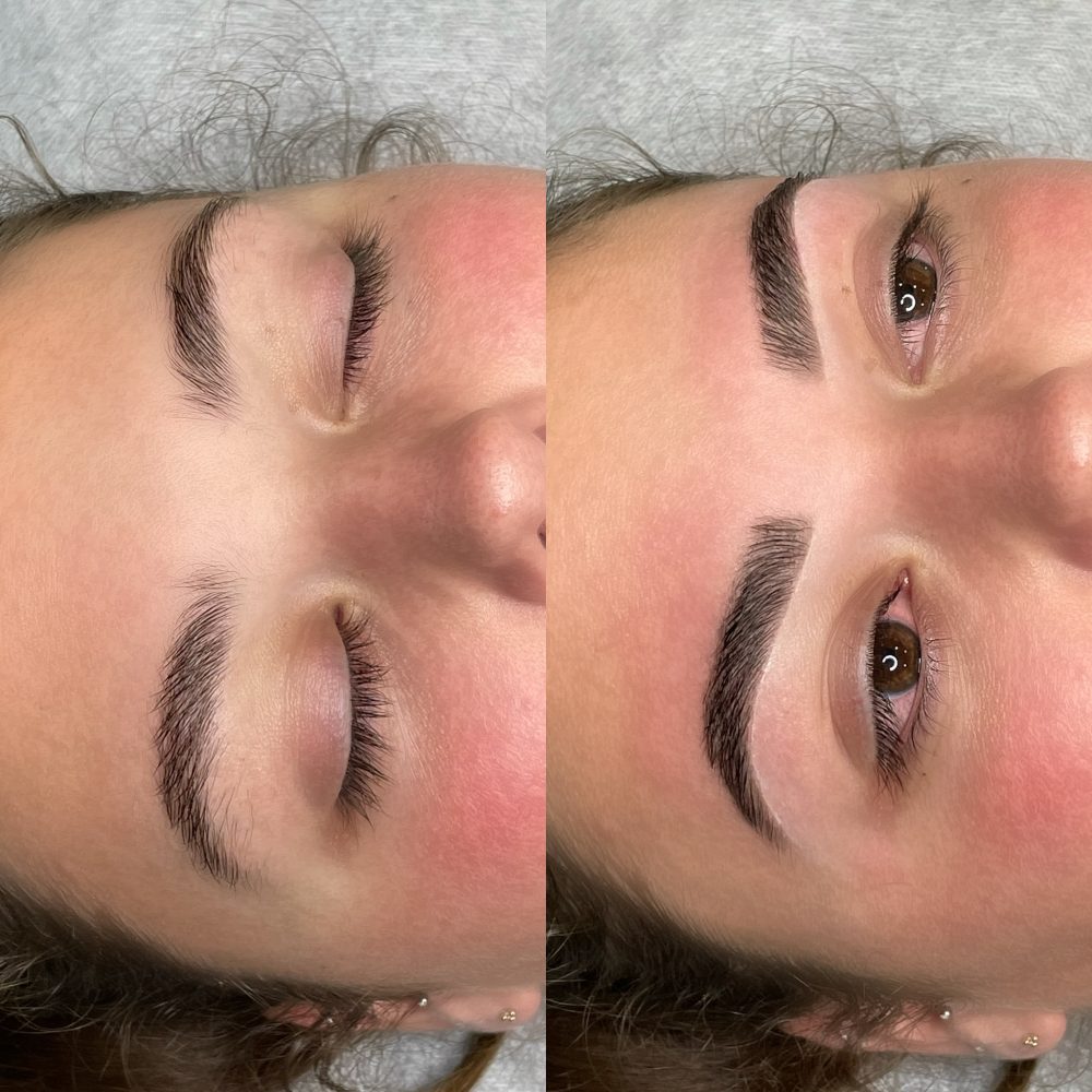 B&A5