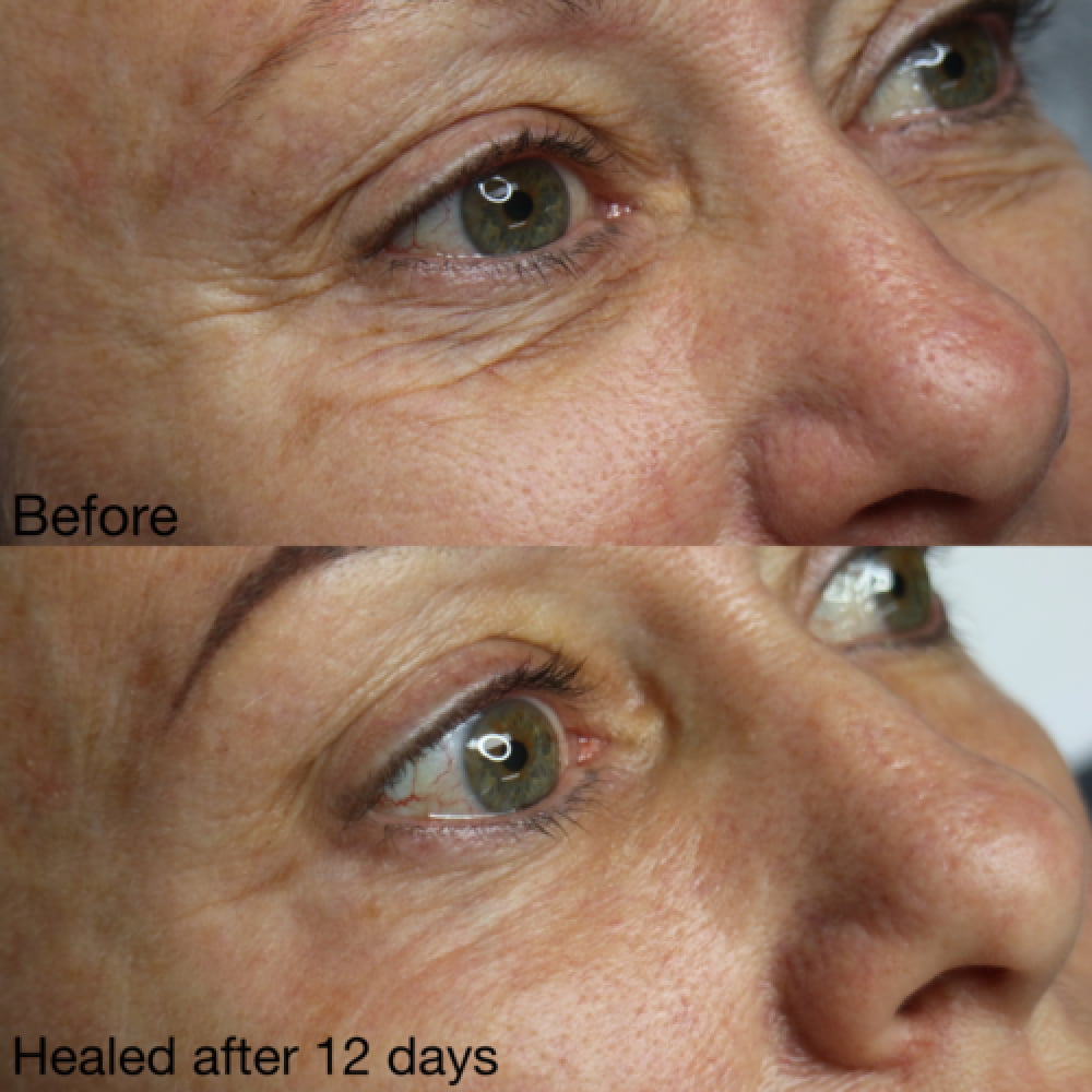 B&A2