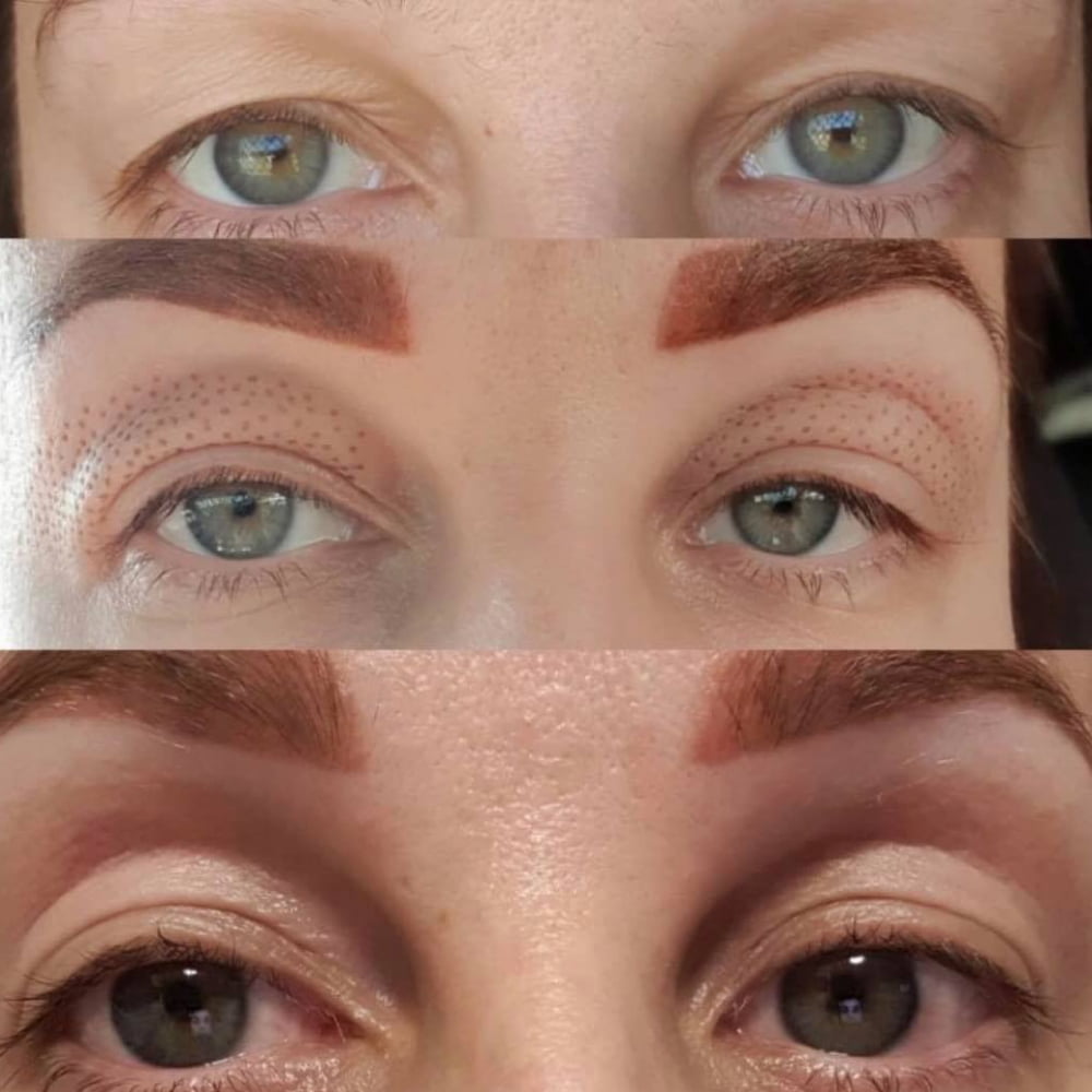 B&A3