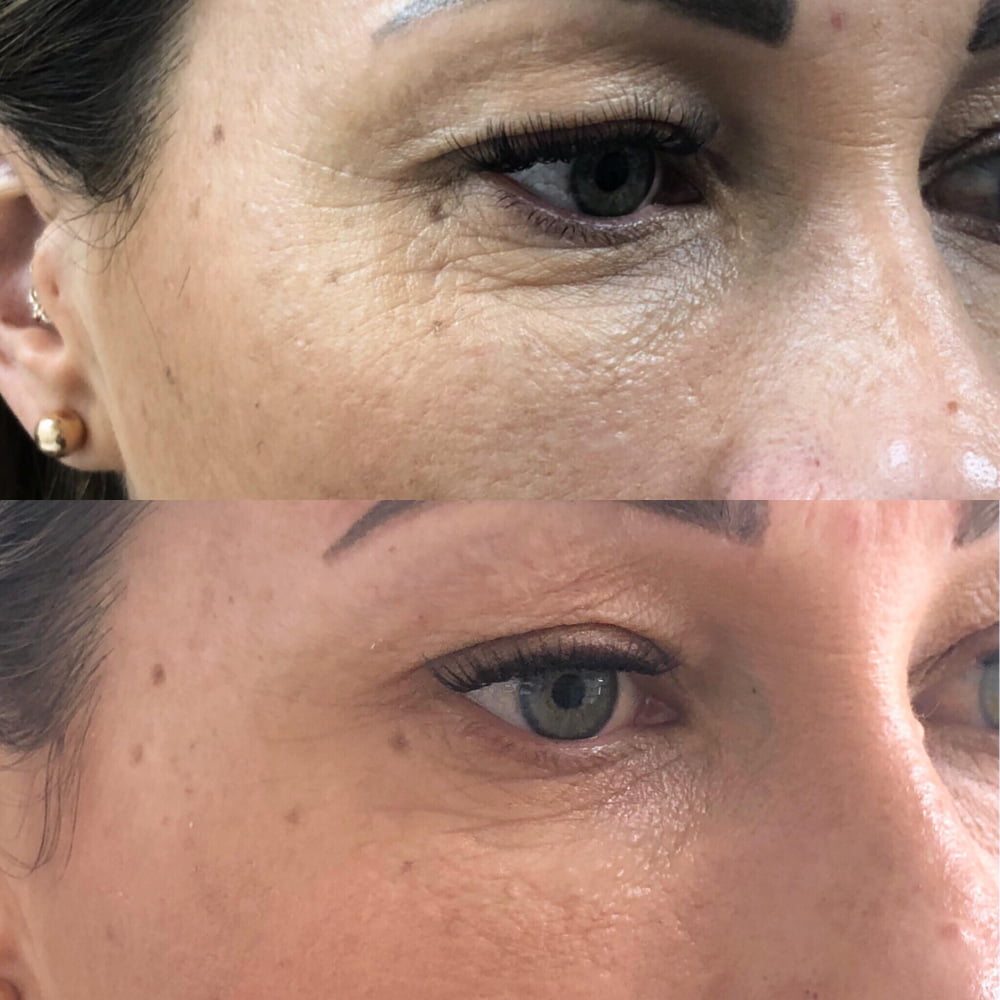 B&A4