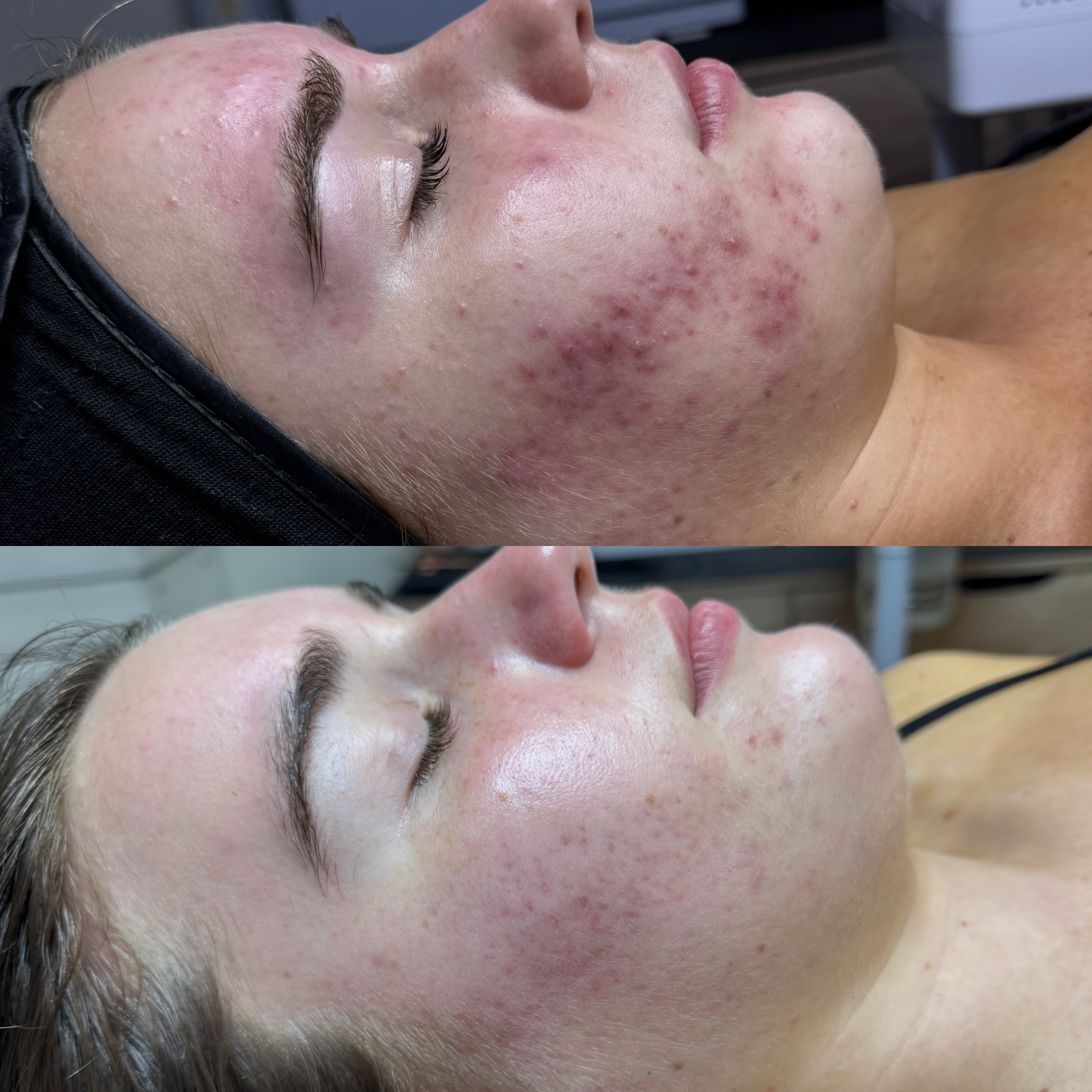 B&A Side Profile