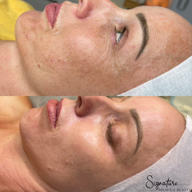 Kelly Kruik 6mth Progression 3